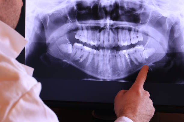Best After-Hours Dental Trauma Care in Pocola, OK