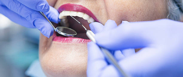 Best Emergency Tooth Extraction in Pocola, OK